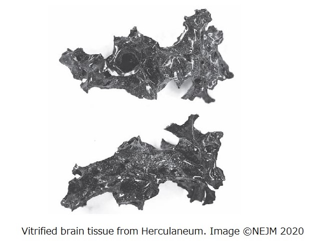 西暦79年のイタリア ベスビオ山噴火の犠牲者の脳が極度の高温でガラス状に変化 伊フェデリコ2世 ナポリ大学報告 Dime アットダイム