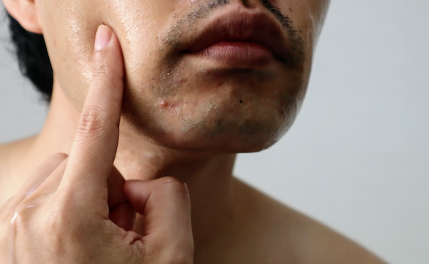 肌荒れに悩む男性がコロナ禍で急増 マスク肌荒れ オンライン映え で高まる男性の美容意識 Dime アットダイム