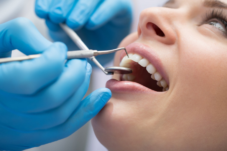 長引くマスク生活で口腔状態が悪化 歯科衛生士の7割が コロナ前より口の中が乾いている患者が増えた Dime アットダイム