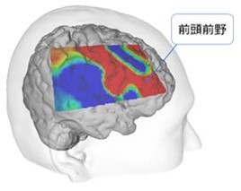 子どもの前頭前野や右脳を活性化させて地頭力を鍛える玩具 アクアビーズ Dime アットダイム