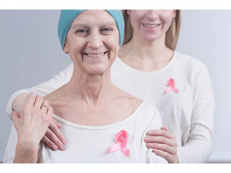 乳がんサバイバーは新たに別のがんを発症するリスクが高い、ケンブリッジ大学研究報告