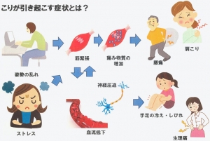 慢性的な肩こりに悩む女性に朗報？オムロイン「温熱低周波治療器」の実力チェック