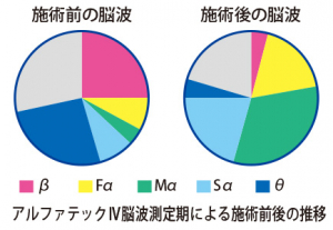 データでも癒し効果を実証