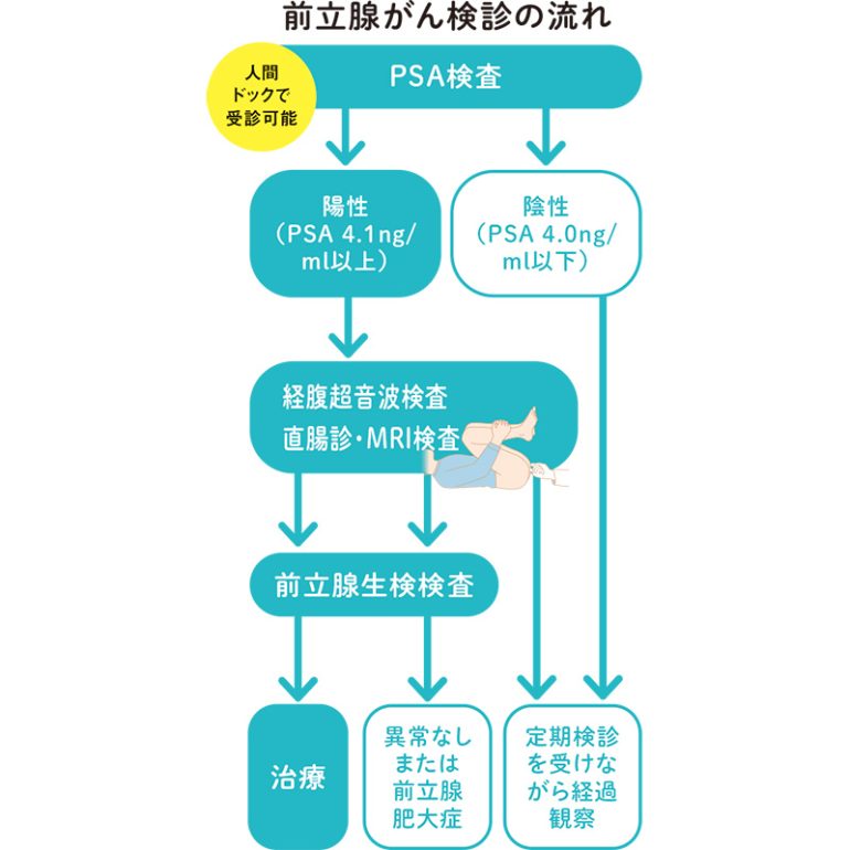 前立腺がん検診