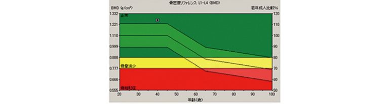 骨粗しょう症ドック