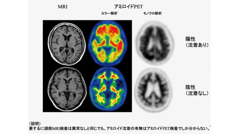 健脳ドック