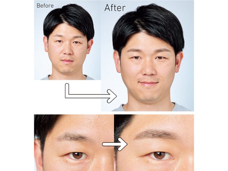 薄眉・まばら眉