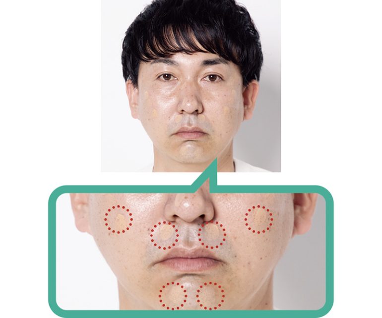 毛穴や口の周り、青ヒゲなどに重ね塗り