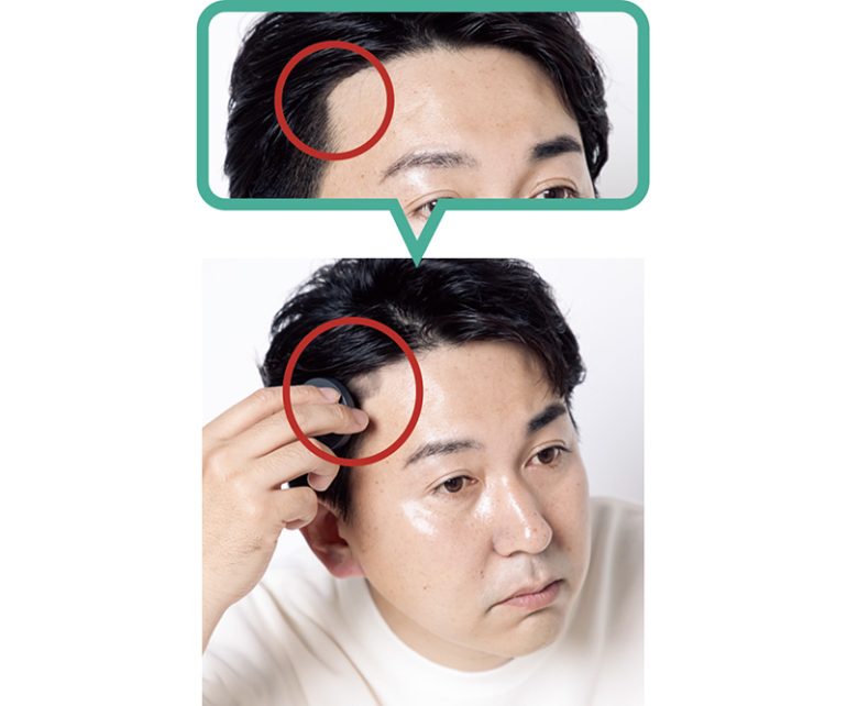 薄毛に見えがちな生え際にポンポン