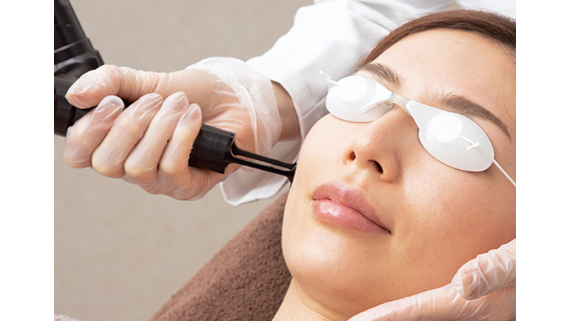 Qスイッチルビーレーザー