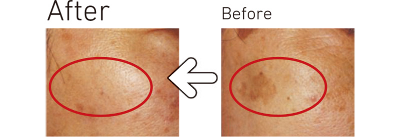 フォトシルクプラス