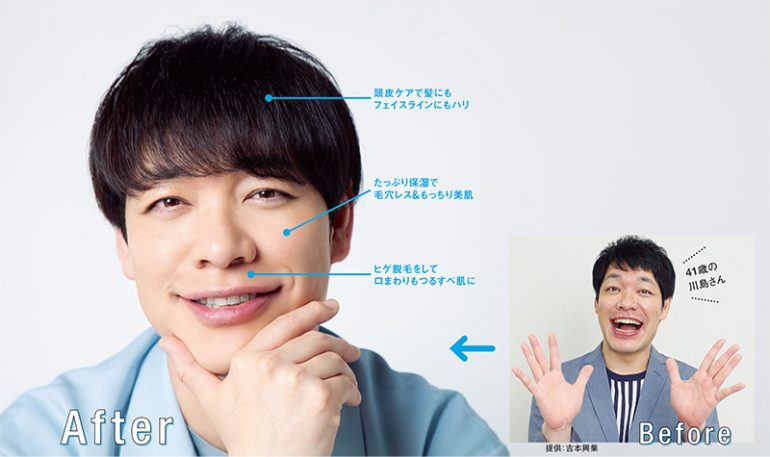 before after