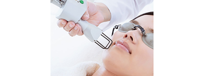 フラクショナル炭酸ガスレーザー