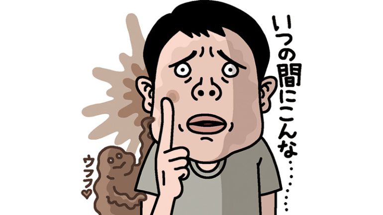 シミ・くすみ