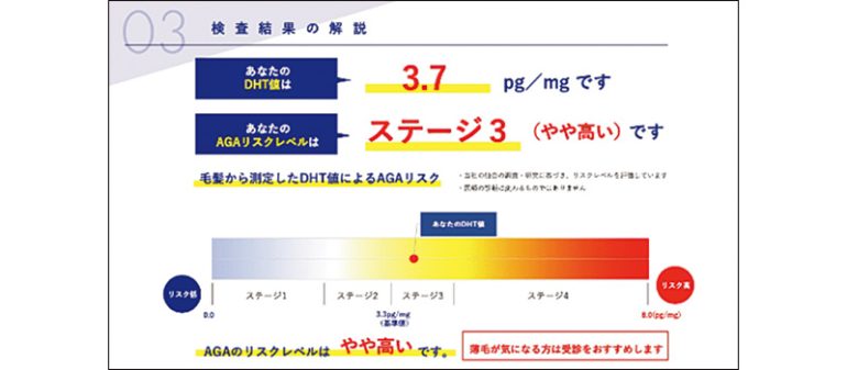 編集部員・ワタナベのAGAリスクが判明!