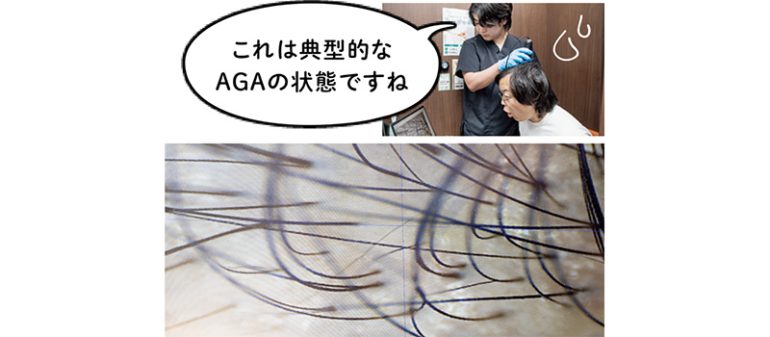 マイクロスコープ検診