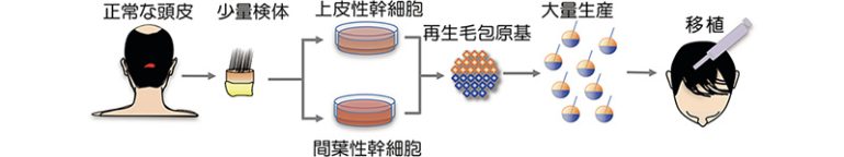 毛包器管の原基を作る毛包再生医療の基本技術