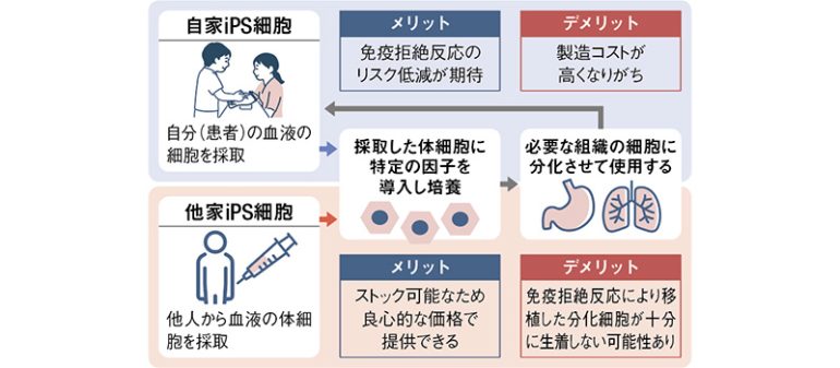 自家iPS細胞